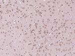 IKK alpha/beta Antibody in Immunohistochemistry (Paraffin) (IHC (P))