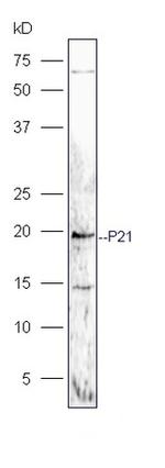P21 Antibody in Western Blot (WB)