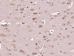 Caspase-6 subunit p11 Antibody in Immunohistochemistry (Paraffin) (IHC (P))