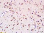 Phospho-Eph receptor B1 (Tyr928) Antibody in Immunohistochemistry (Paraffin) (IHC (P))