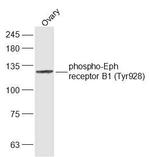 Phospho-Eph receptor B1 (Tyr928) Antibody in Western Blot (WB)