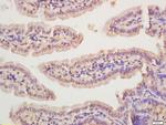 Rad51 Antibody in Immunohistochemistry (Paraffin) (IHC (P))