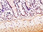 hnRNP M Antibody in Immunohistochemistry (Paraffin) (IHC (P))