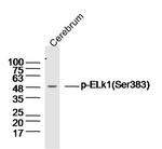 Phospho-ELK1 (Ser383) Antibody in Western Blot (WB)