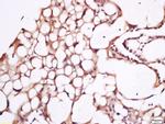 CD274 Antibody in Immunohistochemistry (Paraffin) (IHC (P))