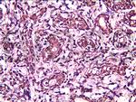 BRMS-1 Antibody in Immunohistochemistry (Paraffin) (IHC (P))