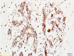 BRMS-1 Antibody in Immunohistochemistry (Paraffin) (IHC (P))
