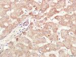 ALDH1 Antibody in Immunohistochemistry (Paraffin) (IHC (P))
