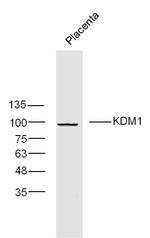 KDM1 Antibody in Western Blot (WB)