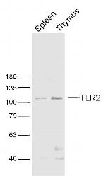 TLR2 Antibody in Western Blot (WB)