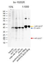 HPV16 E7 Antibody in Western Blot (WB)