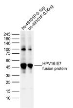 HPV16 E7 Antibody in Western Blot (WB)