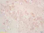 ADORA2B Antibody in Immunohistochemistry (Paraffin) (IHC (P))