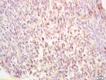 ADORA2B Antibody in Immunohistochemistry (Paraffin) (IHC (P))