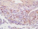 Phospho-IRAK4 (Thr345) Antibody in Immunohistochemistry (Paraffin) (IHC (P))