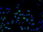 ERK1 Antibody in Immunocytochemistry (ICC/IF)