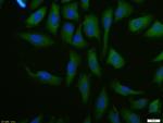 FoxP3 Antibody in Immunocytochemistry (ICC/IF)