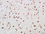 FoxP3 Antibody in Immunohistochemistry (Paraffin) (IHC (P))