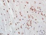 FoxP3 Antibody in Immunohistochemistry (Paraffin) (IHC (P))