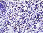 FoxP3 Antibody in Immunohistochemistry (Paraffin) (IHC (P))