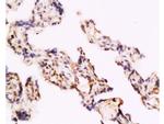 TLR4 Antibody in Immunohistochemistry (Paraffin) (IHC (P))