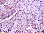 TLR4 Antibody in Immunohistochemistry (Paraffin) (IHC (P))