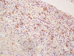 Inhibin Alpha Antibody in Immunohistochemistry (Paraffin) (IHC (P))