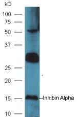 Inhibin Alpha Antibody in Western Blot (WB)