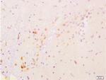GDNF Antibody in Immunohistochemistry (Paraffin) (IHC (P))