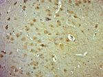 Phospho-Cofilin (Ser24) Antibody in Immunohistochemistry (Paraffin) (IHC (P))