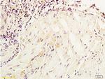 NSE Antibody in Immunohistochemistry (Paraffin) (IHC (P))