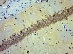 NSE Antibody in Immunohistochemistry (Paraffin) (IHC (P))