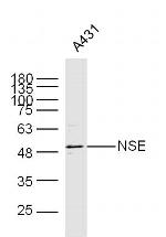 NSE Antibody in Western Blot (WB)