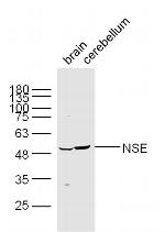 NSE Antibody in Western Blot (WB)