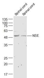 NSE Antibody in Western Blot (WB)