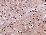 NF-L Antibody in Immunohistochemistry (Paraffin) (IHC (P))