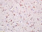 Hrk Antibody in Immunohistochemistry (Paraffin) (IHC (P))