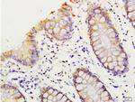 HMGA1 Antibody in Immunohistochemistry (Paraffin) (IHC (P))