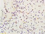 HMGA1 Antibody in Immunohistochemistry (Paraffin) (IHC (P))