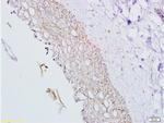 Inhibin Alpha Antibody in Immunohistochemistry (Paraffin) (IHC (P))