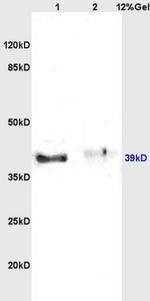 Inhibin Alpha Antibody in Western Blot (WB)