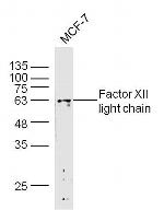 Factor I heavy chain Antibody in Western Blot (WB)