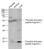 Thrombin Activation peptide fragment 1 Antibody in Western Blot (WB)