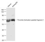 Thrombin Activation peptide fragment 1 Antibody in Western Blot (WB)