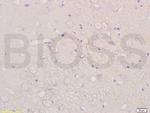 CHRNA4 Antibody in Immunohistochemistry (Paraffin) (IHC (P))