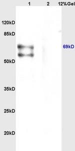 CHRNA4 Antibody in Western Blot (WB)