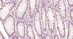 Factor 8 beta chain Antibody in Immunohistochemistry (Paraffin) (IHC (P))