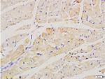factor 5 Antibody in Immunohistochemistry (Paraffin) (IHC (P))