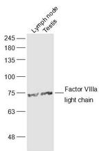 Factor 8a light chain Antibody in Western Blot (WB)
