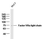 Factor 8a light chain Antibody in Western Blot (WB)